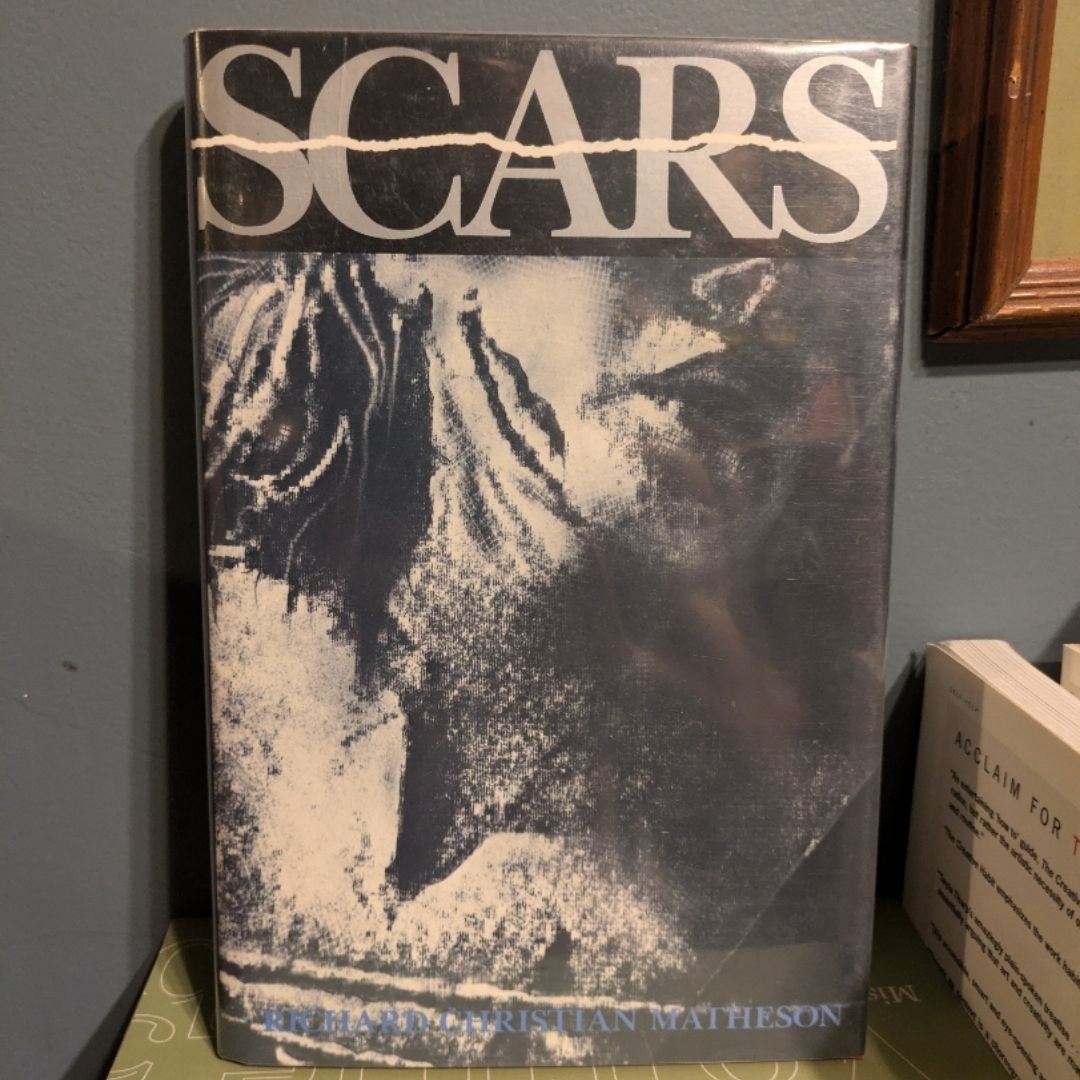 Scars