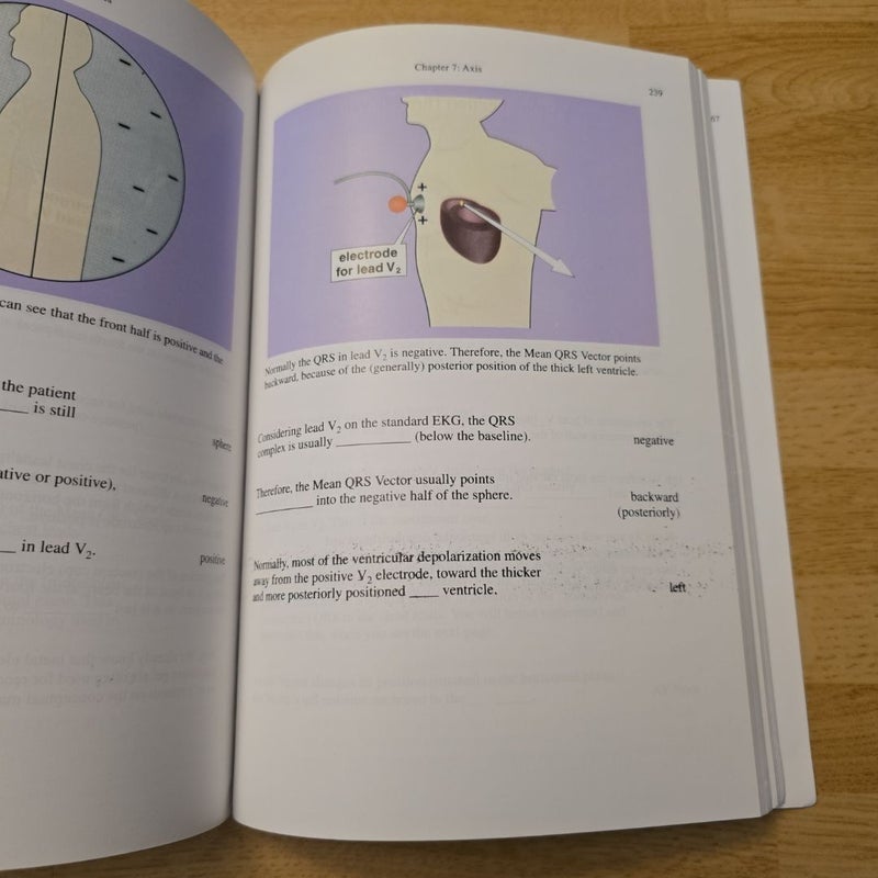Rapid Interpretation of EKG's 6th Edition