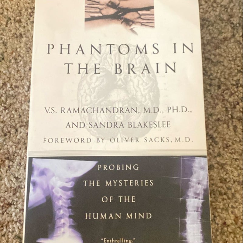 Phantoms in the Brain