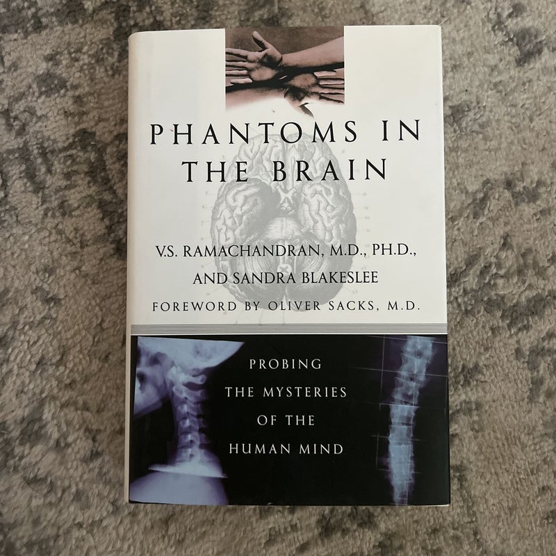 Phantoms in the Brain