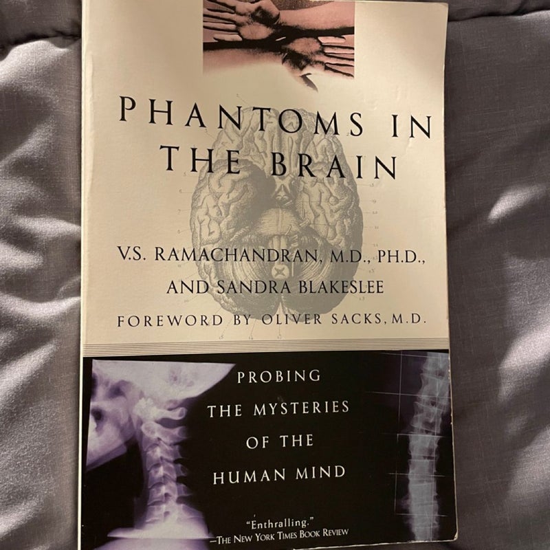 Phantoms in the Brain