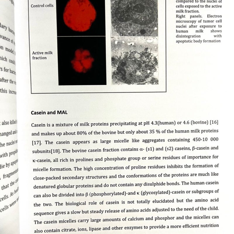 Human Milk and Cancer Research:Rare Dissertation on Tumor Killing Molecules 2010