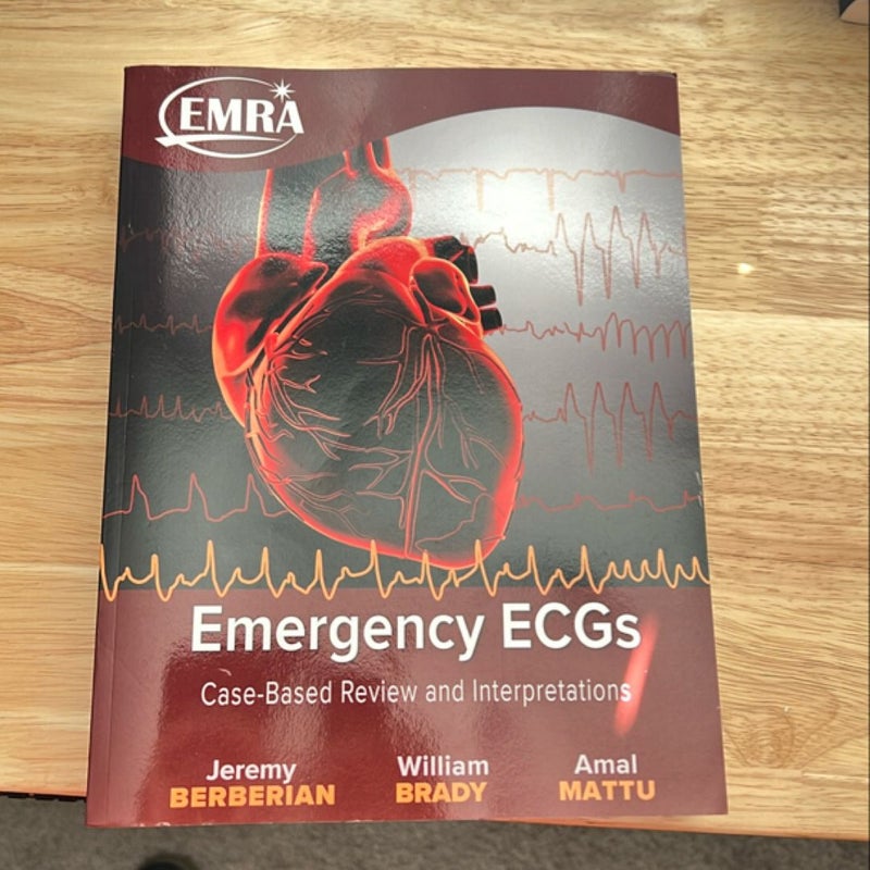 Emergency ECGs - Print