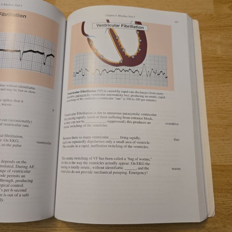 Rapid Interpretation of EKG's 6th edition