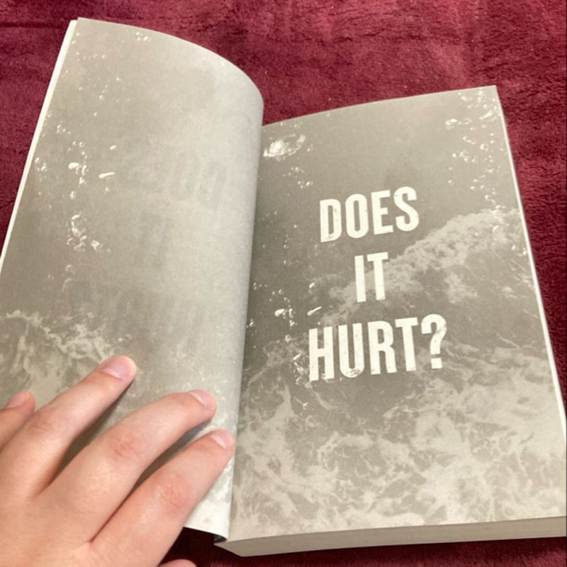 Does It Hurt?