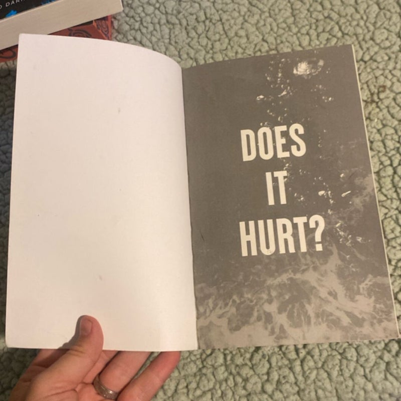 Does It Hurt?