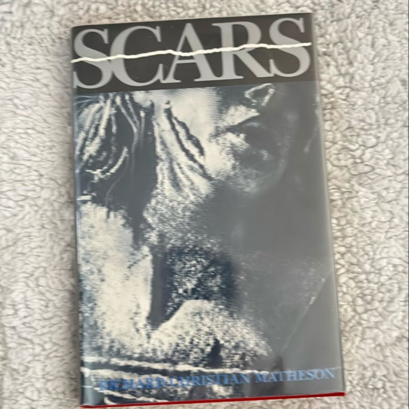 Scars