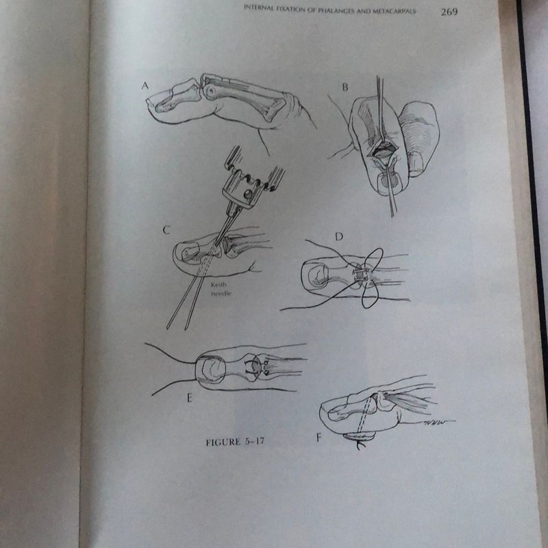 Atlas of Hand Surgery volume 2