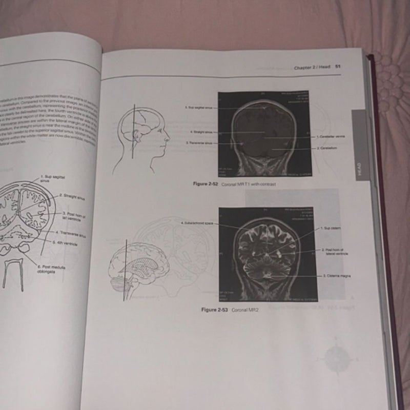 Introduction to Sectional Anatomy