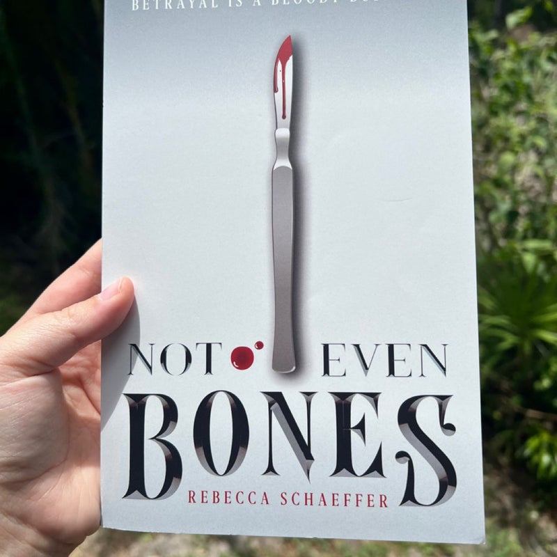 Not Even Bones