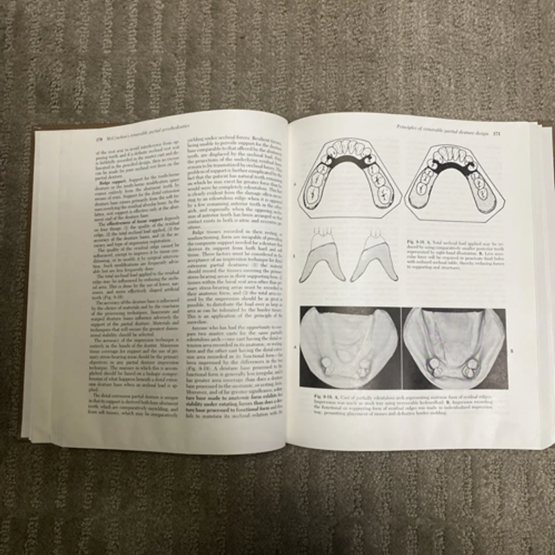 McCracken's Removable Partial Prosthodontics by Henderson, Dentistry Book