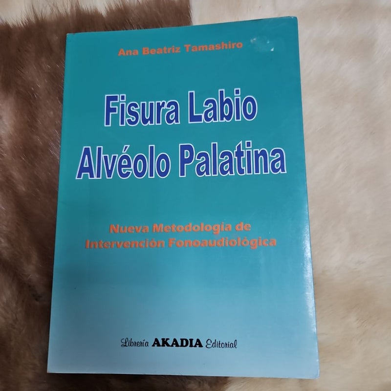 Fisura labio alvéolo palatina