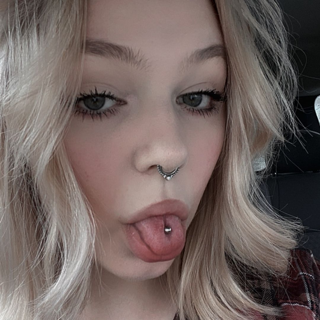 Abby