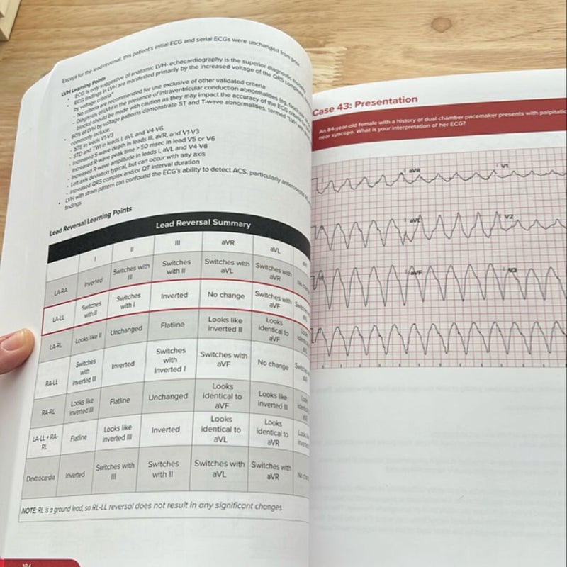 Emergency ECGs - Print