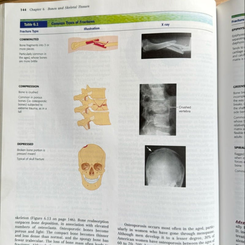 Human Anatomy Update