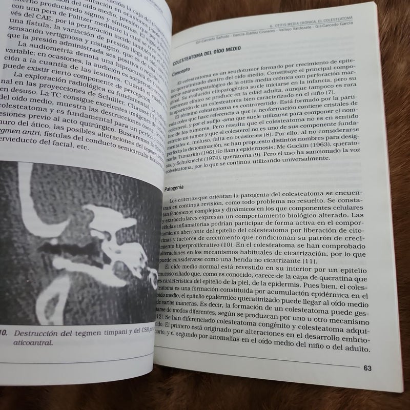 Otologia: enfermedades inflamatorias e hipoacusias de transmisión 