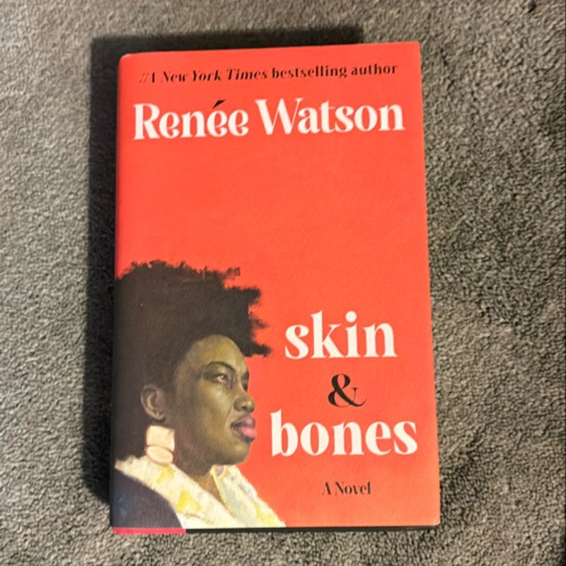 Skin and Bones