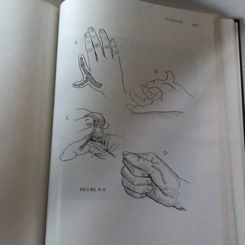 Atlas of Hand Surgery by Robert A. Chase