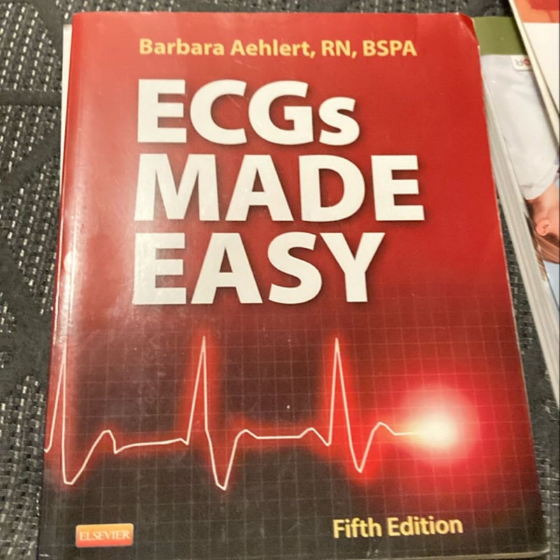 ECGs Made Easy