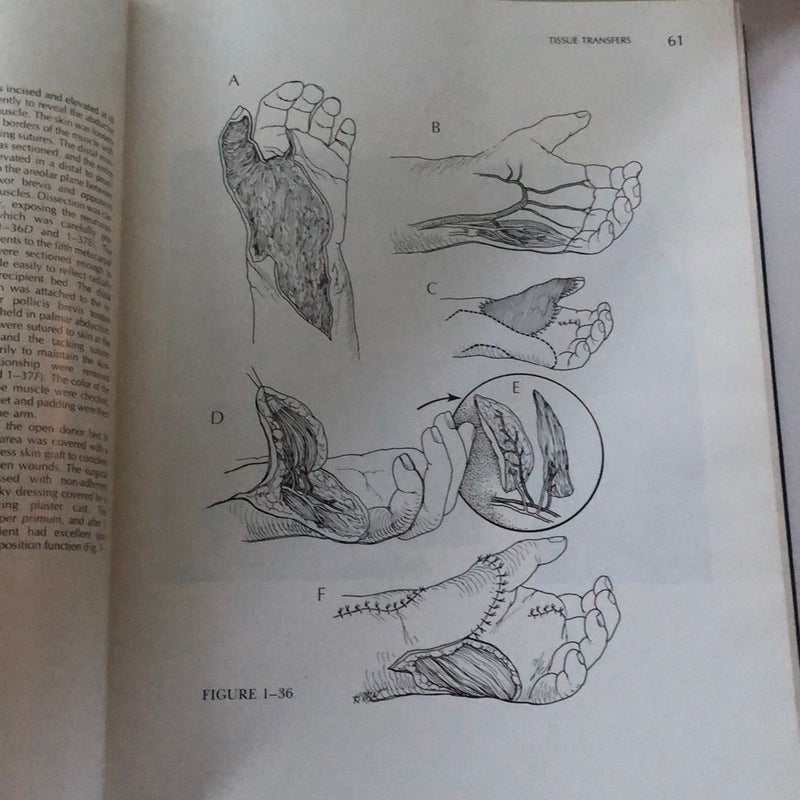 健康・医学 A Comprehensive Atlas of Hand Surgery Atlas of Hand Surgery: Conolly, W. Bruce: 9780443050770