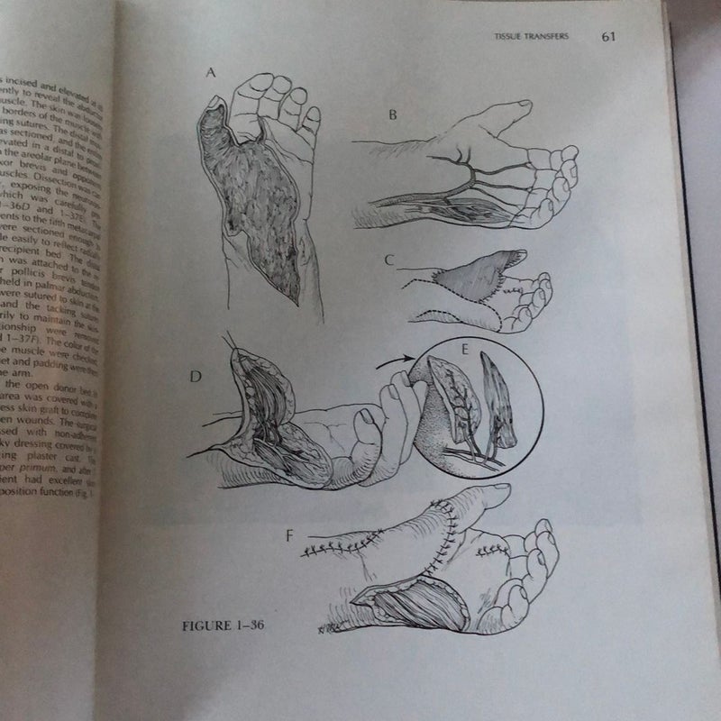 Atlas of Hand Surgery volume 2