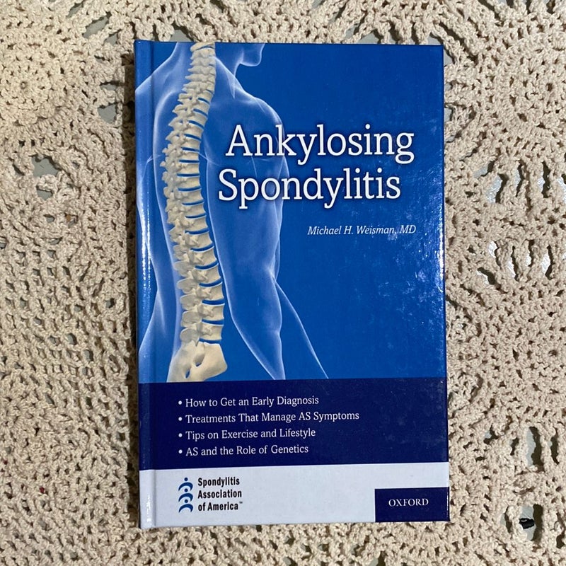 Ankylosing Spondylitis