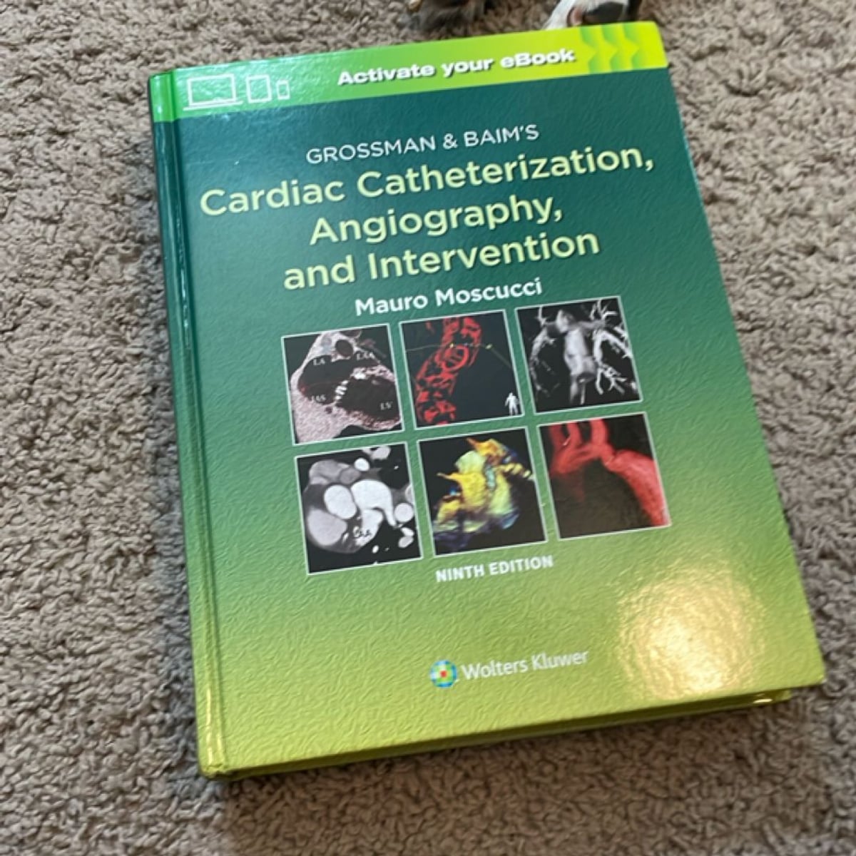 Grossman and Baim's Cardiac Catheterization, Angiography, and ...
