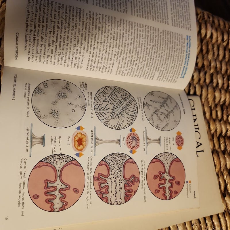 2 book lot: Clinical Symposia