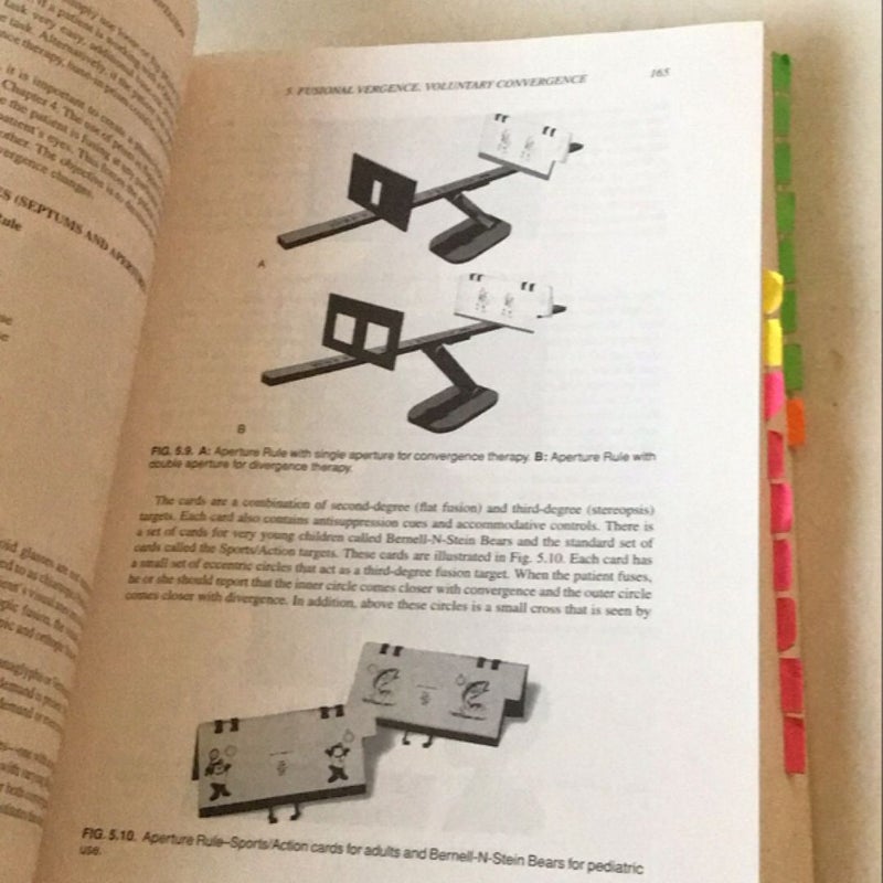 Clinical Management of Binocular Vision