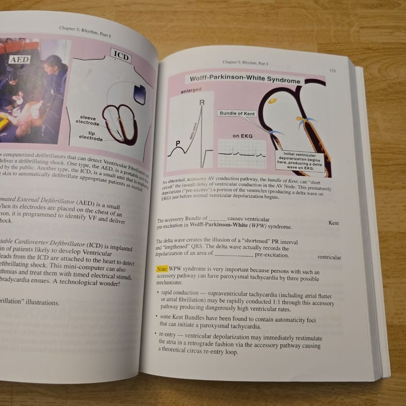 Rapid Interpretation of EKG's 6th Edition