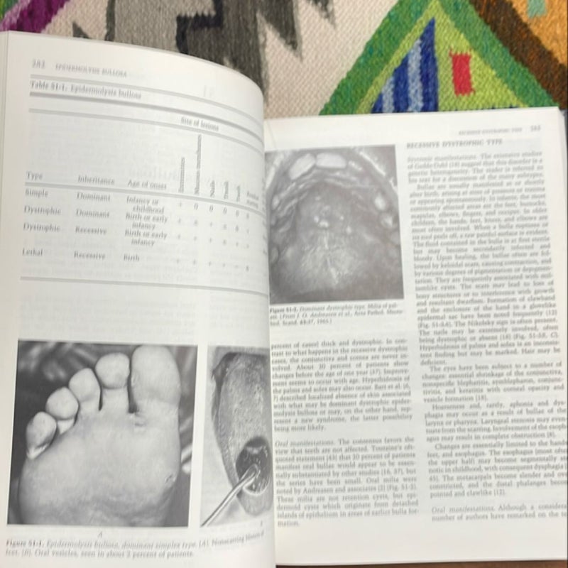 Syndromes of the Head and Neck (second edition)