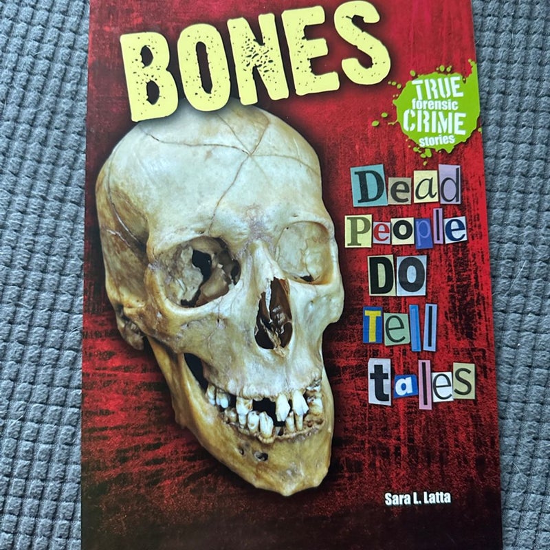 Bones