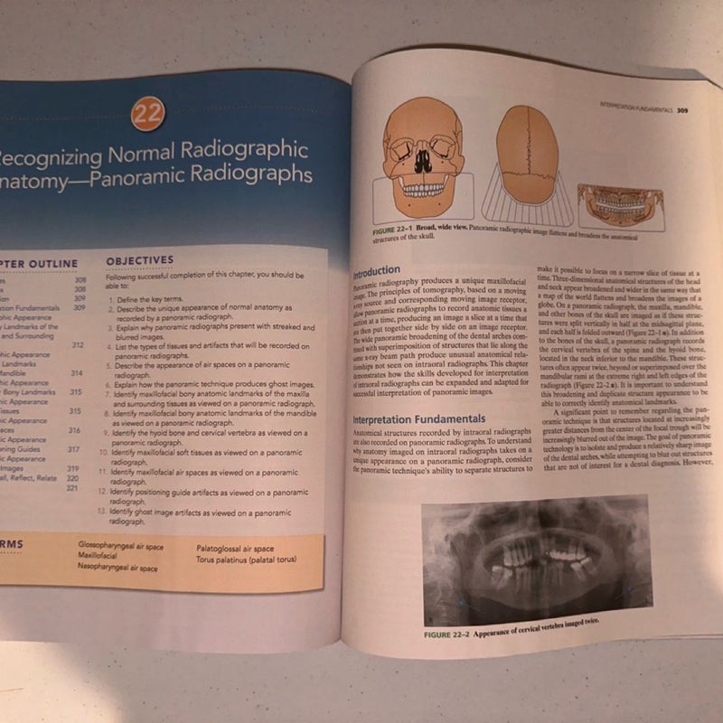 Essentials of Dental Radiography for Dental Assistants and Hygienists