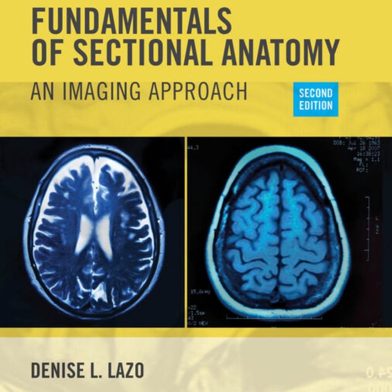 Workbook for Lazo's Fundamentals of Sectional Anatomy: an Imaging Approach, 2nd