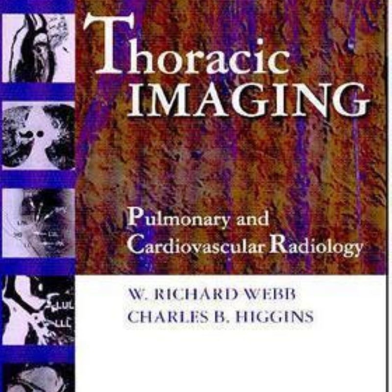 Thoracic Imaging