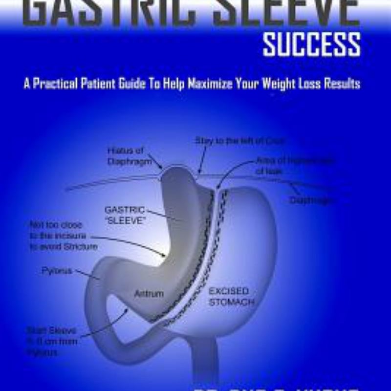 Ultimate Gastric Sleeve Success