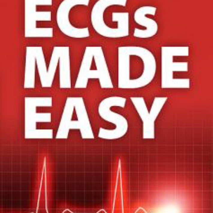 Pocket Reference for ECGs Made Easy