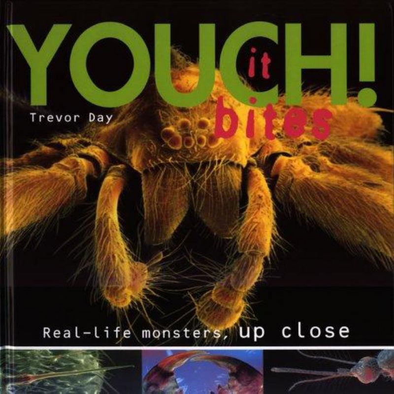 Youch!
