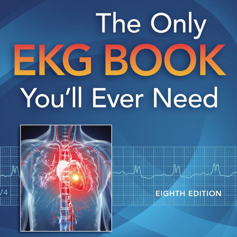 Only EKG Book You'll Ever Need