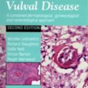 An Atlas of Vulval Diseases